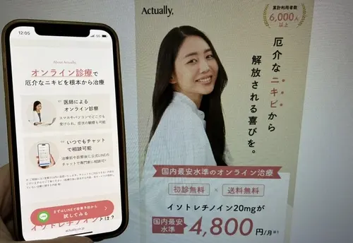 アクチュアリーのニキビ治療