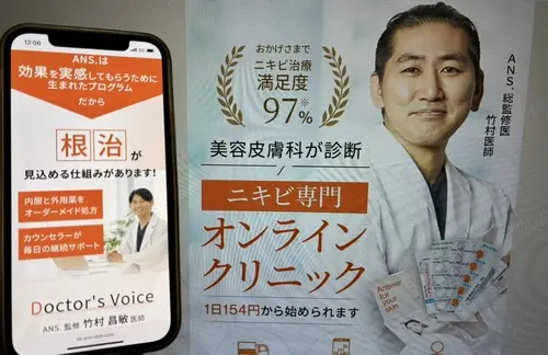 ANS（アンス）のニキビ治療