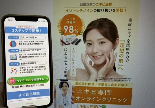 あしたのクリニックのニキビ治療